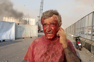 تصاویر مصدومان خونین انفجار بیروت ۱۳+